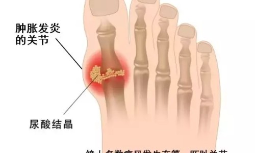 【直肠肿瘤动手术没有生命危险吧】直肠肿瘤术后不良症状有哪些表现 - 直肠肿瘤术后不良症状有哪些网